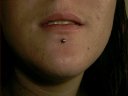 Labret piercing